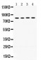 Anti-POR Picoband Antibody